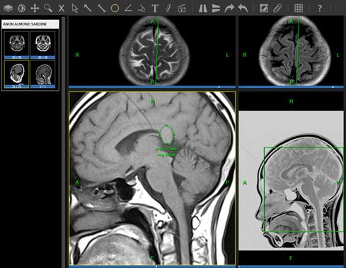 A medical image displayed in MedXT.